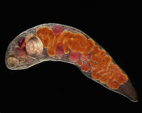  Gigantostoma Spinigerum: Ein trematoden Wurm, der eine Reise durch die Körperwelt unternimmt!